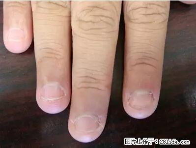 剪指甲、挖耳屎，这些日常小动作竟隐藏大危害！ - 连云港生活资讯 - 连云港28生活网 lyg.28life.net